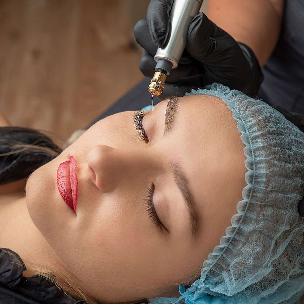 Plasma fibroblast skin-tightening treatment at candibrows