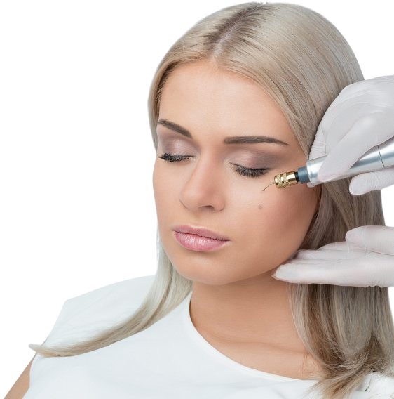 Plasma fibroblast treatment at candibrows tightening and lifting loose skin