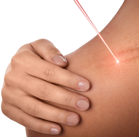 Paramedical scar and burn camouflage at candibrows for natural, confidence-boosting results